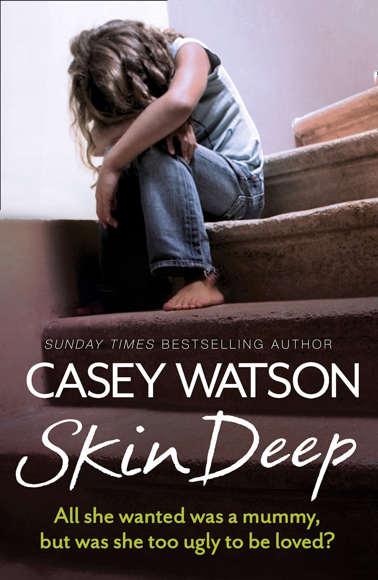 Cover image for Skin Deep: All She Wanted Was a Mummy, But Was She Too Ugly to Be Loved?, isbn: 9780007595105