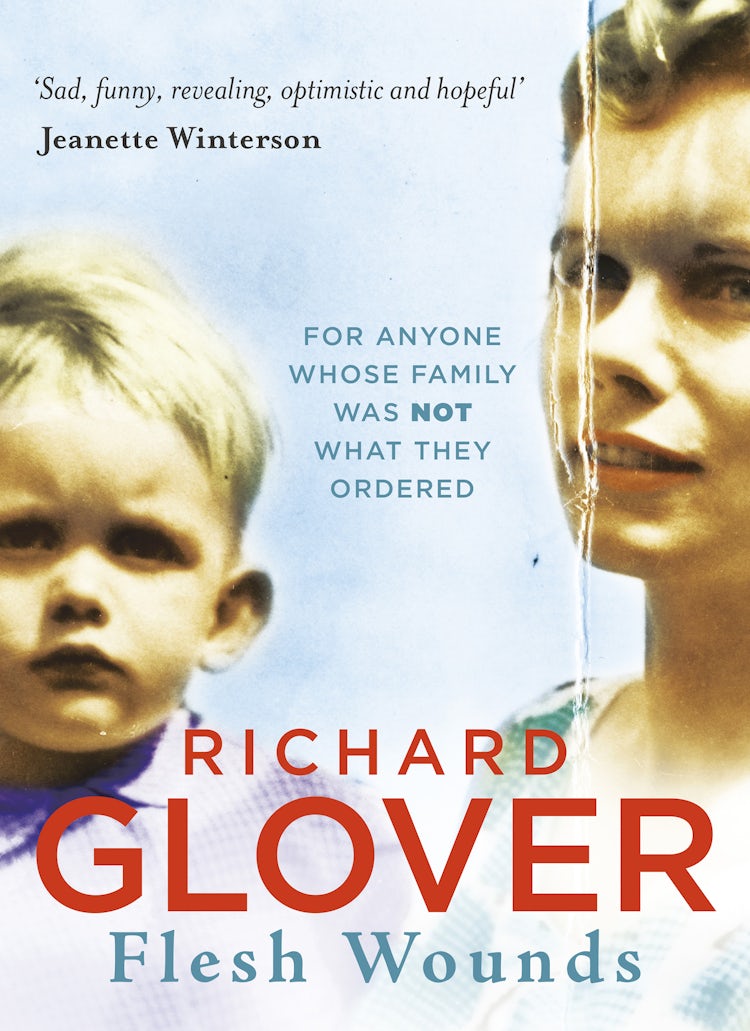 Cover image for Flesh Wounds, isbn: 9781460705025